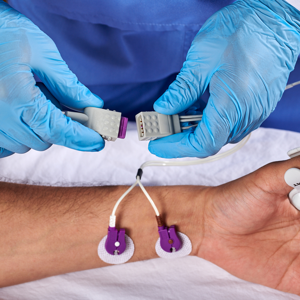 Cable para sensor de transmisión neuromuscular, 3.3M/11Ft Cable para sensor de transmisión neuromuscular, 3.3M/11Ft